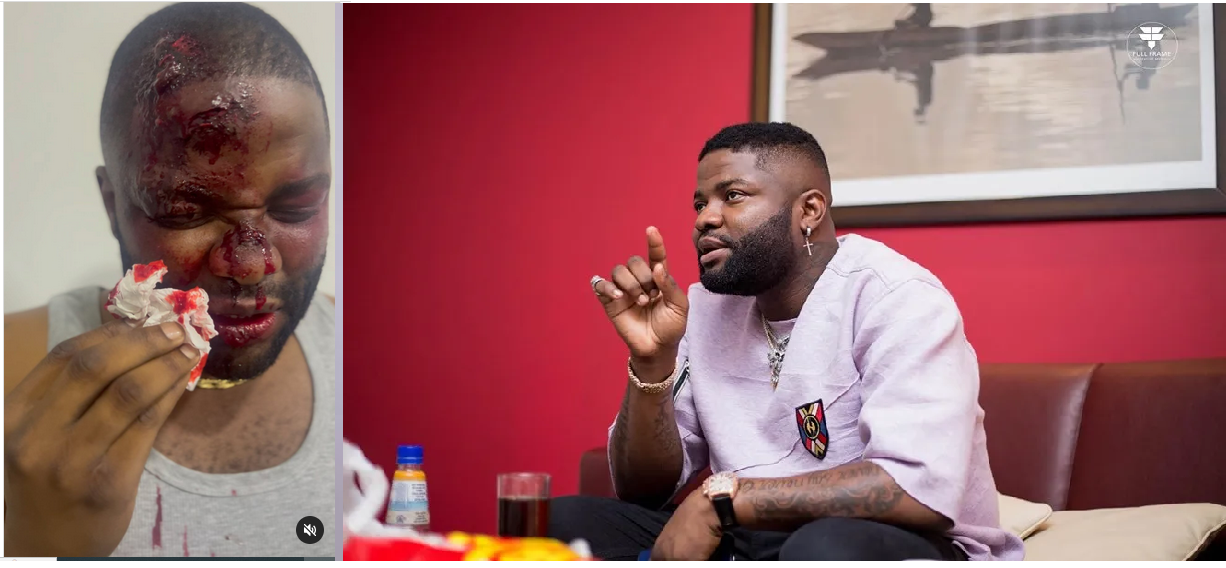 Skales posts disturbing video on Instagram and followers react